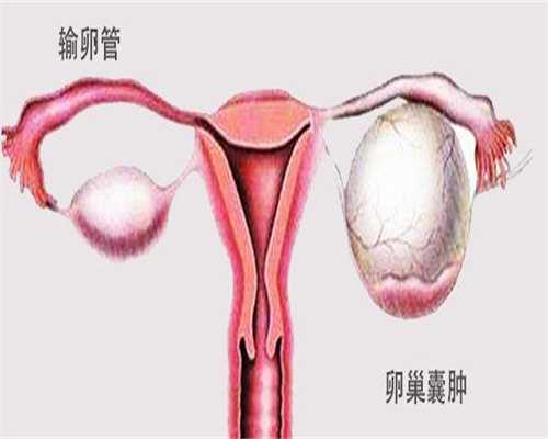 温州供卵试管婴儿费用多少钱？2025费用明细与套餐参考